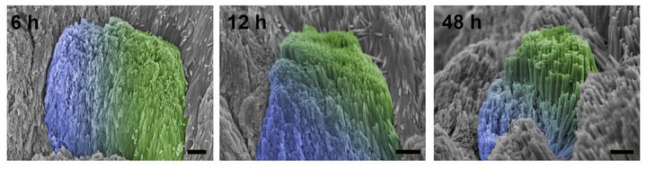 Эмаль «схватывается» на залеченном зубе добровольца: синим окрашены области с естественной эмалью, зеленым — с искусственной. Изображение: Zhejiang University / Science Advances