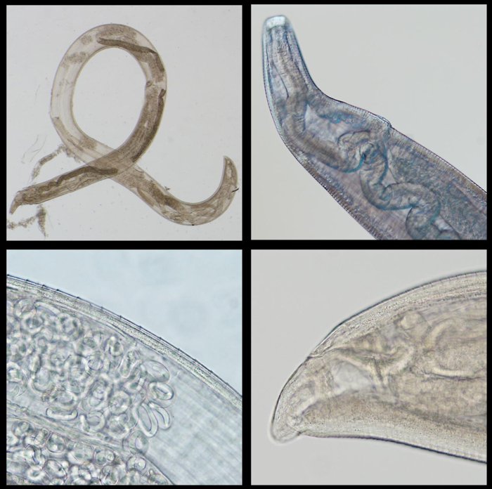 Изображение самки червя T. gulosa. Фото: Clinical Infectious Diseases