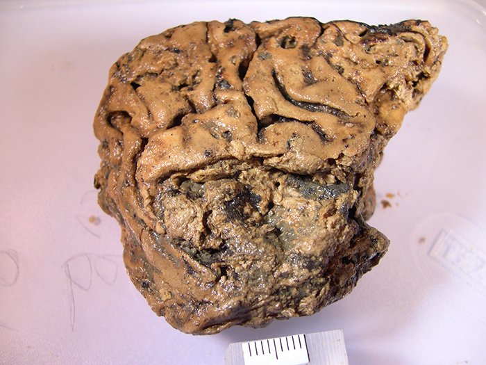 Мозг из Хенслингтона