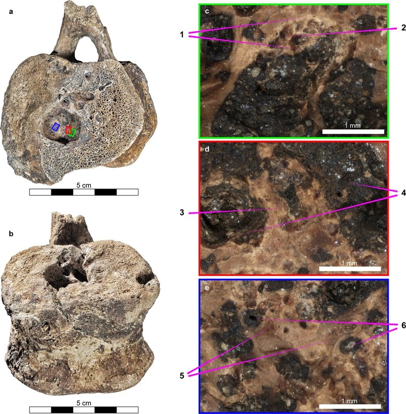 В Канаде обнаружены останки динозавра гадрозаврида, на позвонках которого сохранились следы гистиоцитоза X — редкой формы рака